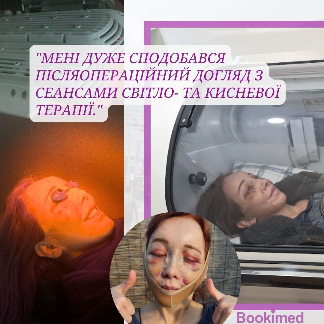 догляд після підтяжки обличчя