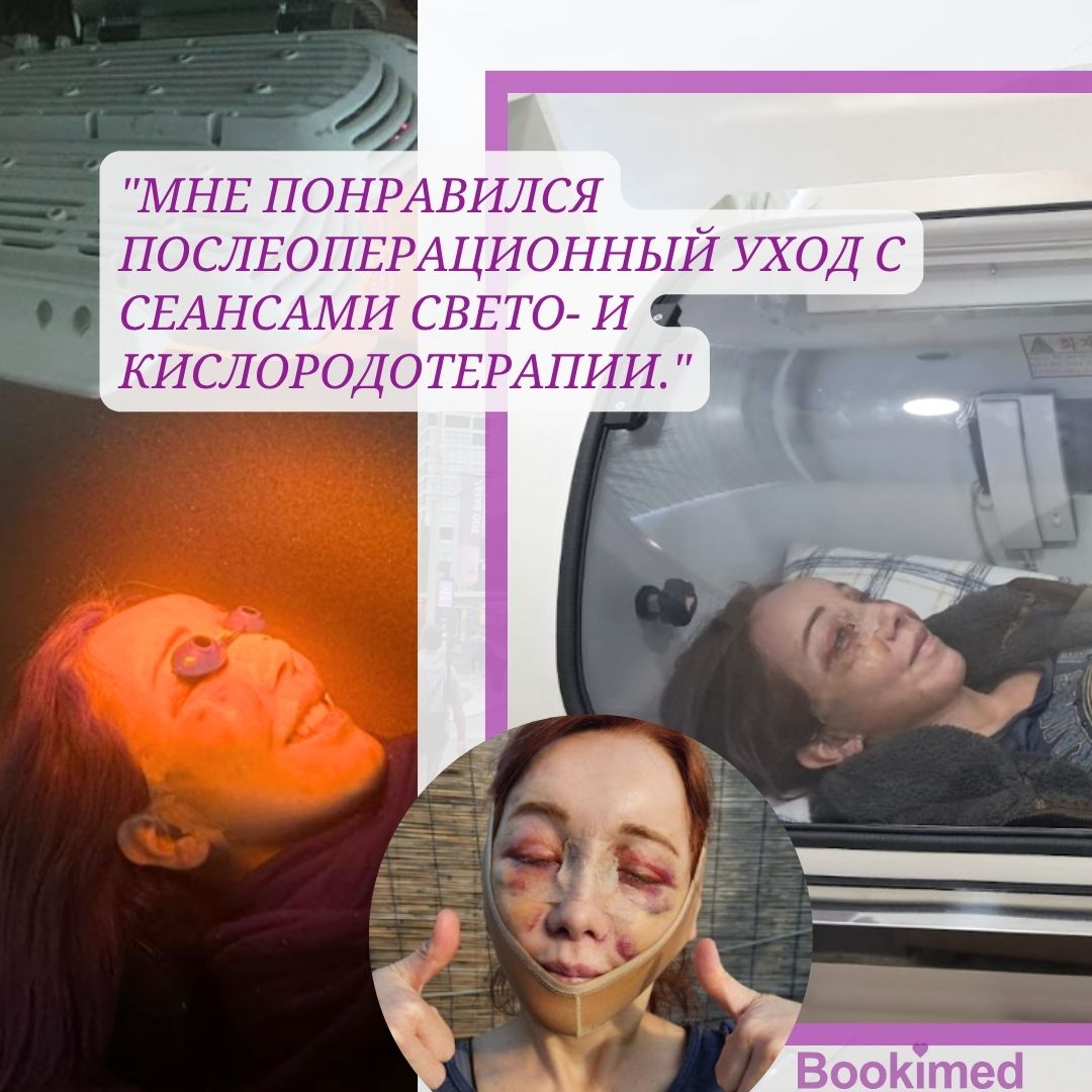 уход после подтяжки лица