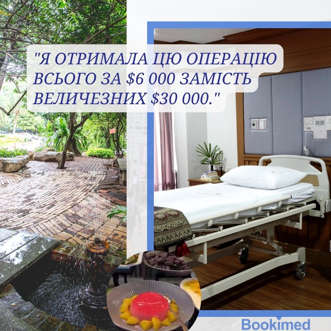 досвід ліпосакції