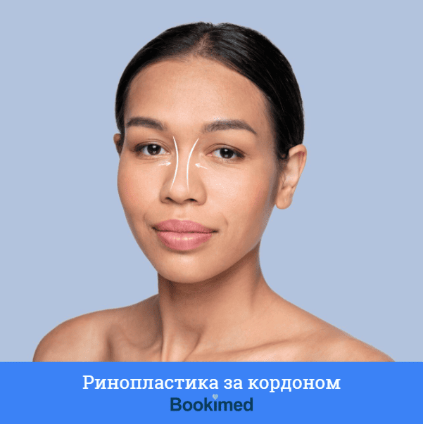 пластичний хірург форми носа