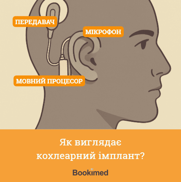 пристрій кохлеарного нерва