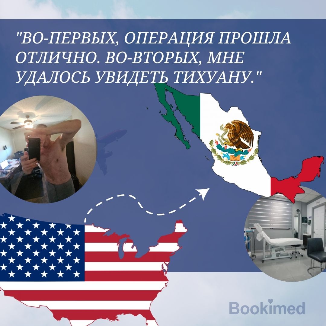 пекторальные импланты до и после