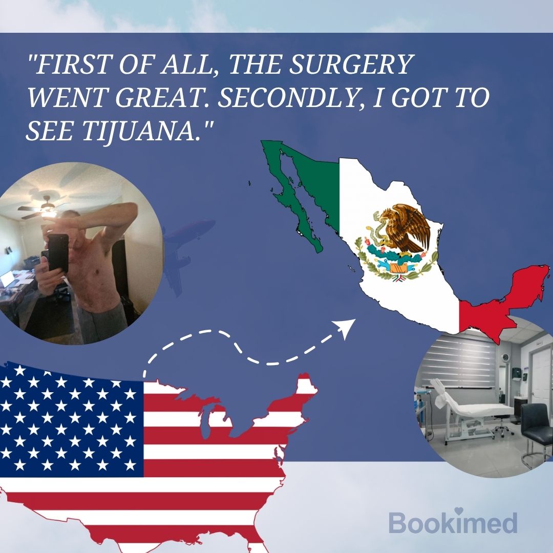 pectoral before and after