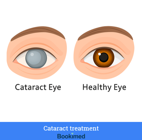 edical tourism - cataract surgery cost thailand WITH monofocal lens