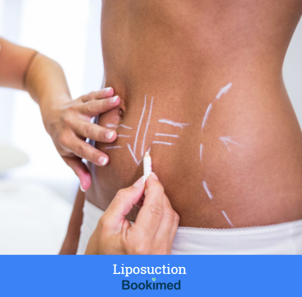 liposuction procedure in Thailand - patients wear compression garments for surrounding tissues