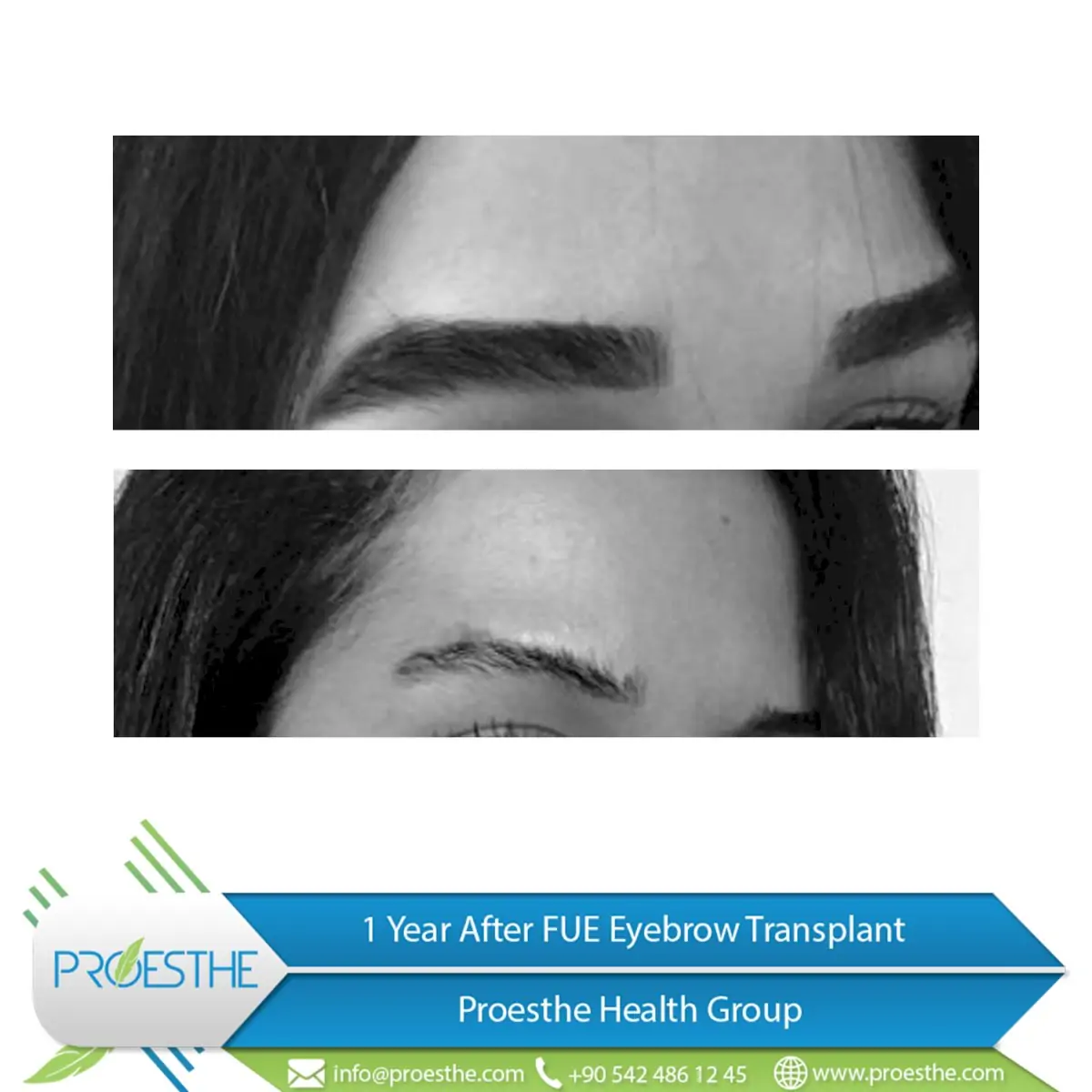 Proesthe Hair Transplant Center