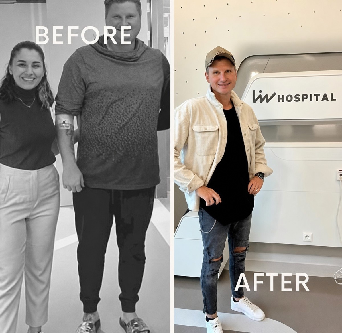 Before and after gastric bypass at Kraemer Medical – significant weight loss result