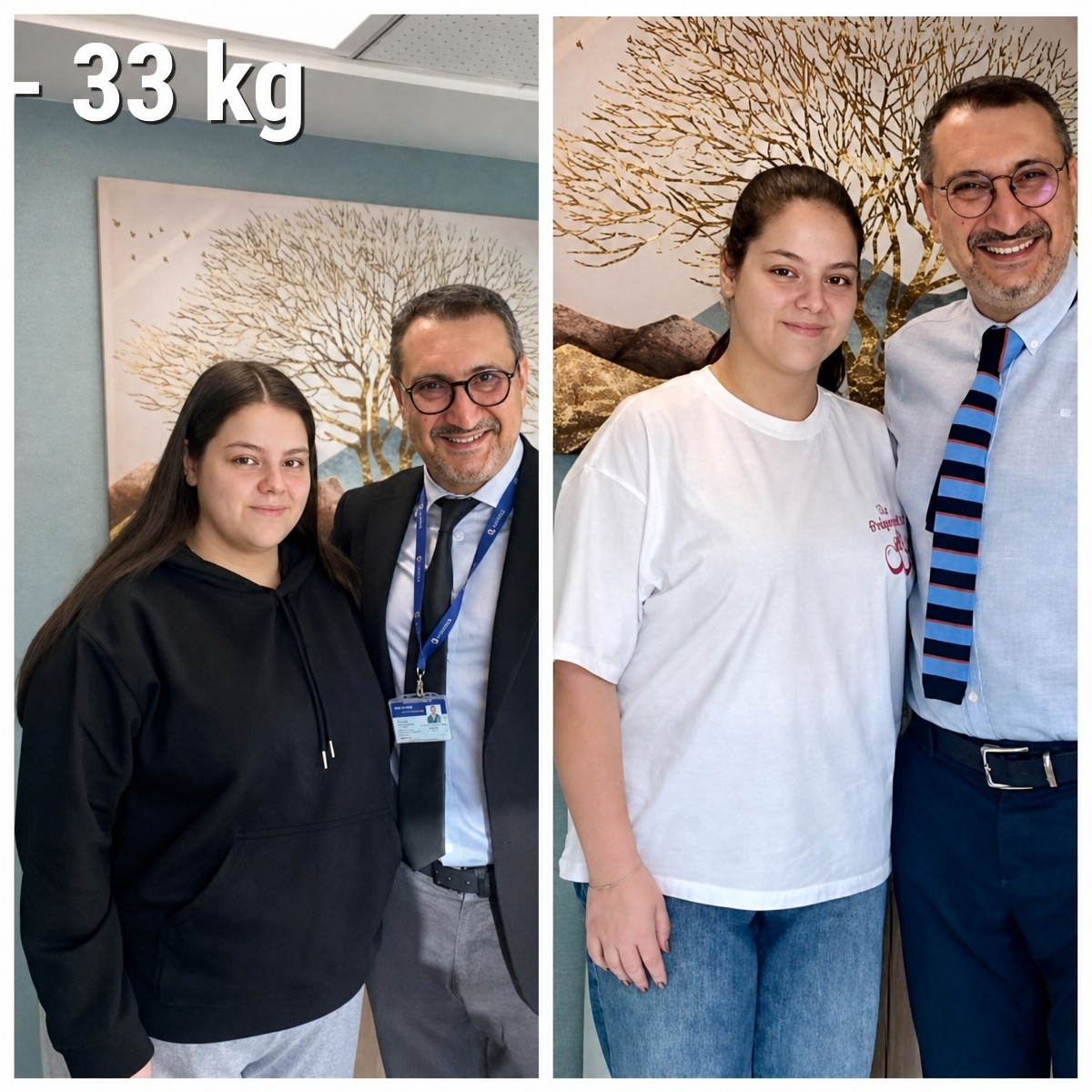 Efekty przed i po operacji rękawowej w Medipol University Pendik Hospital, wynik -33 kg