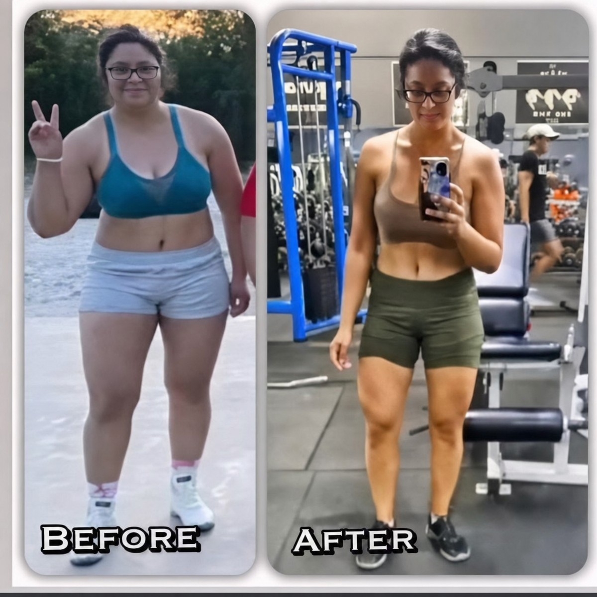 Resultados antes y después del balón gástrico en OBESITY FREE-DR. GABRIEL ROSALES, pérdida de peso visible