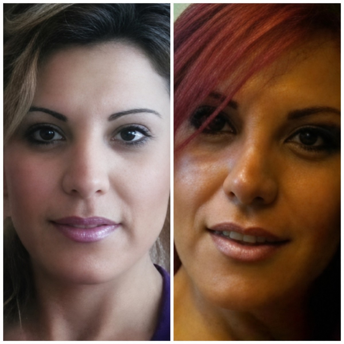 Resultados de rinoplastia antes y después en Dr. Arturo Muñoz Meza Plastic Surgery