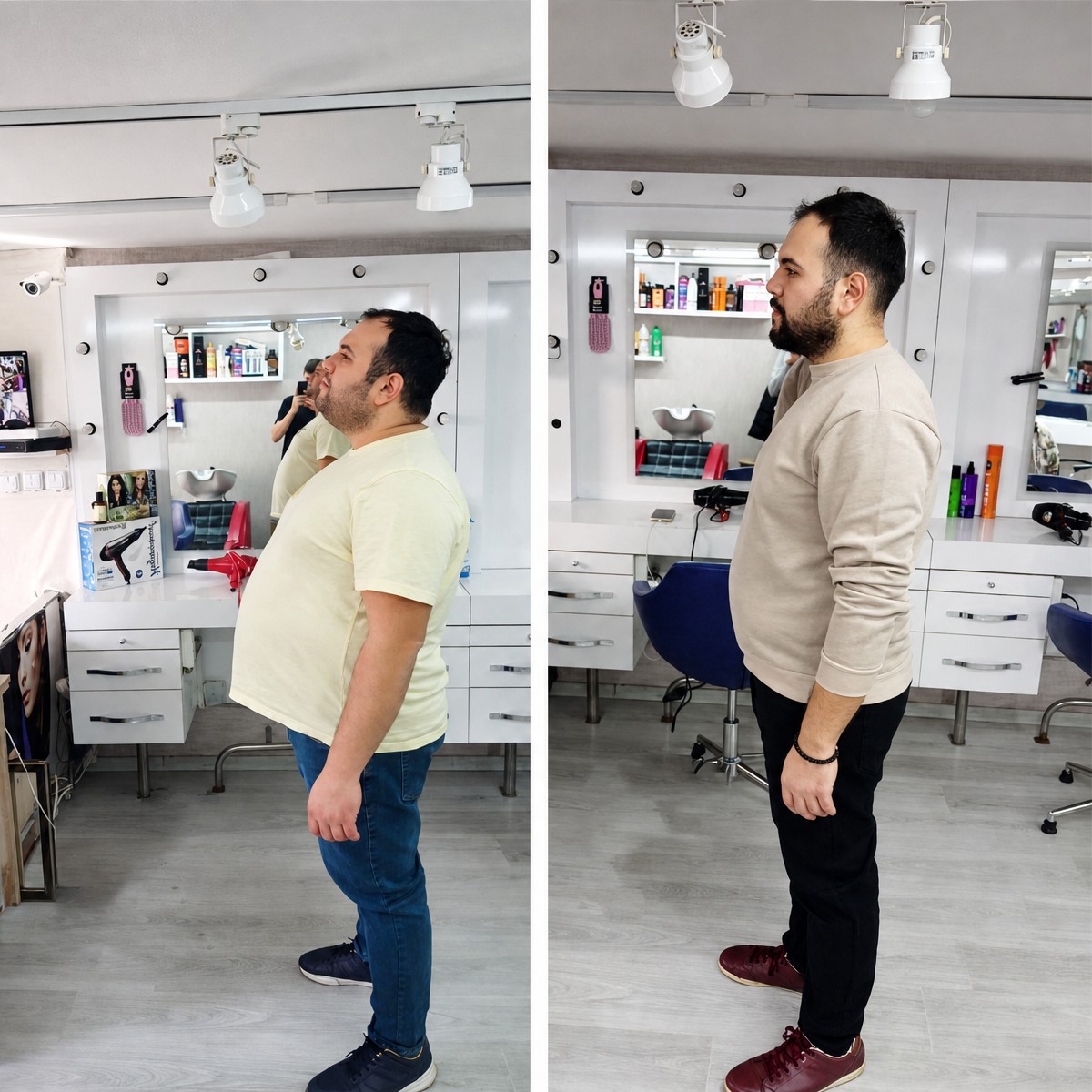قبل وبعد جراحة تحويل مسار المعدة في Associate Professor M. Derda Ozer DERDA SAGLIK HIZMETLERI، نتيجة فقدان الوزن
