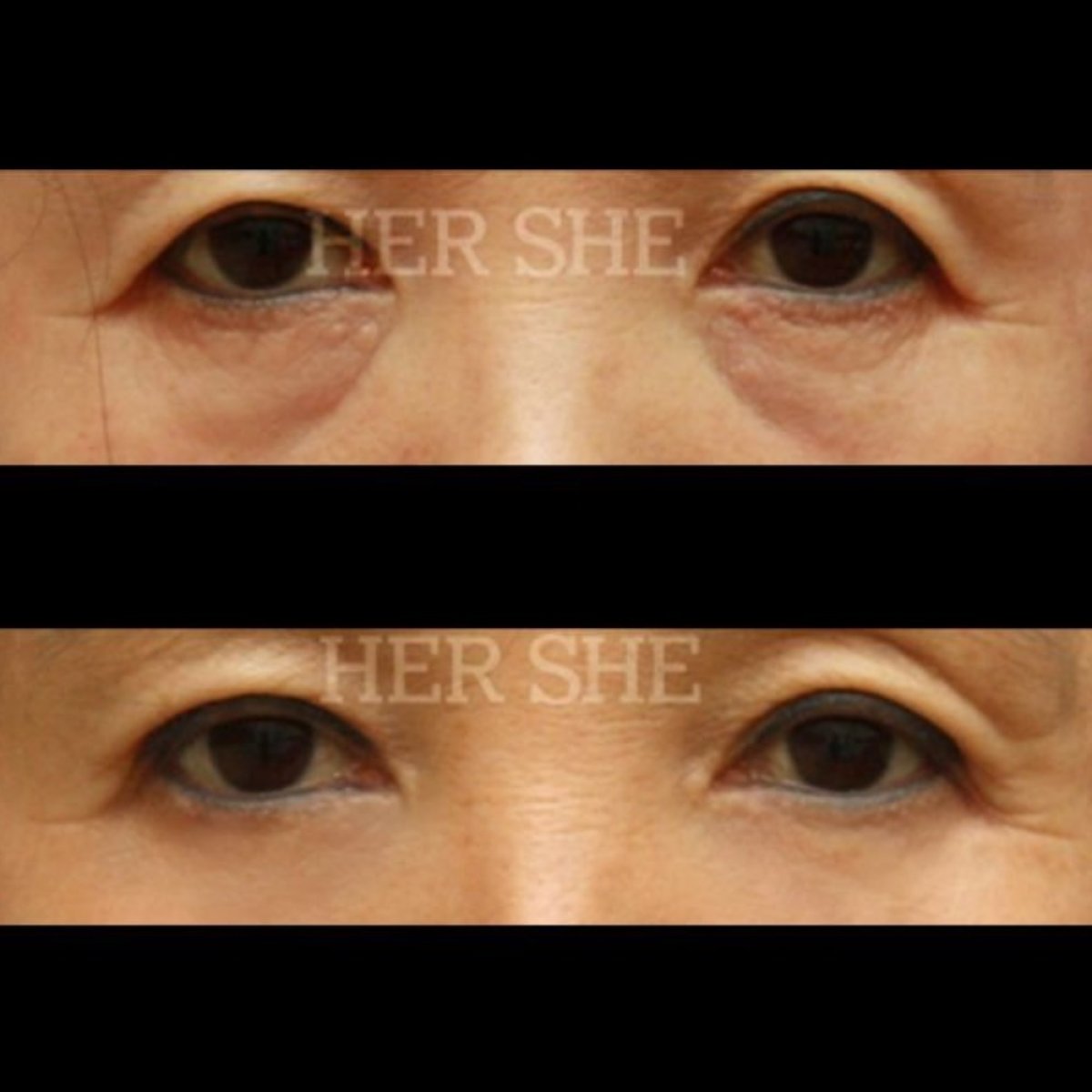 photo #1