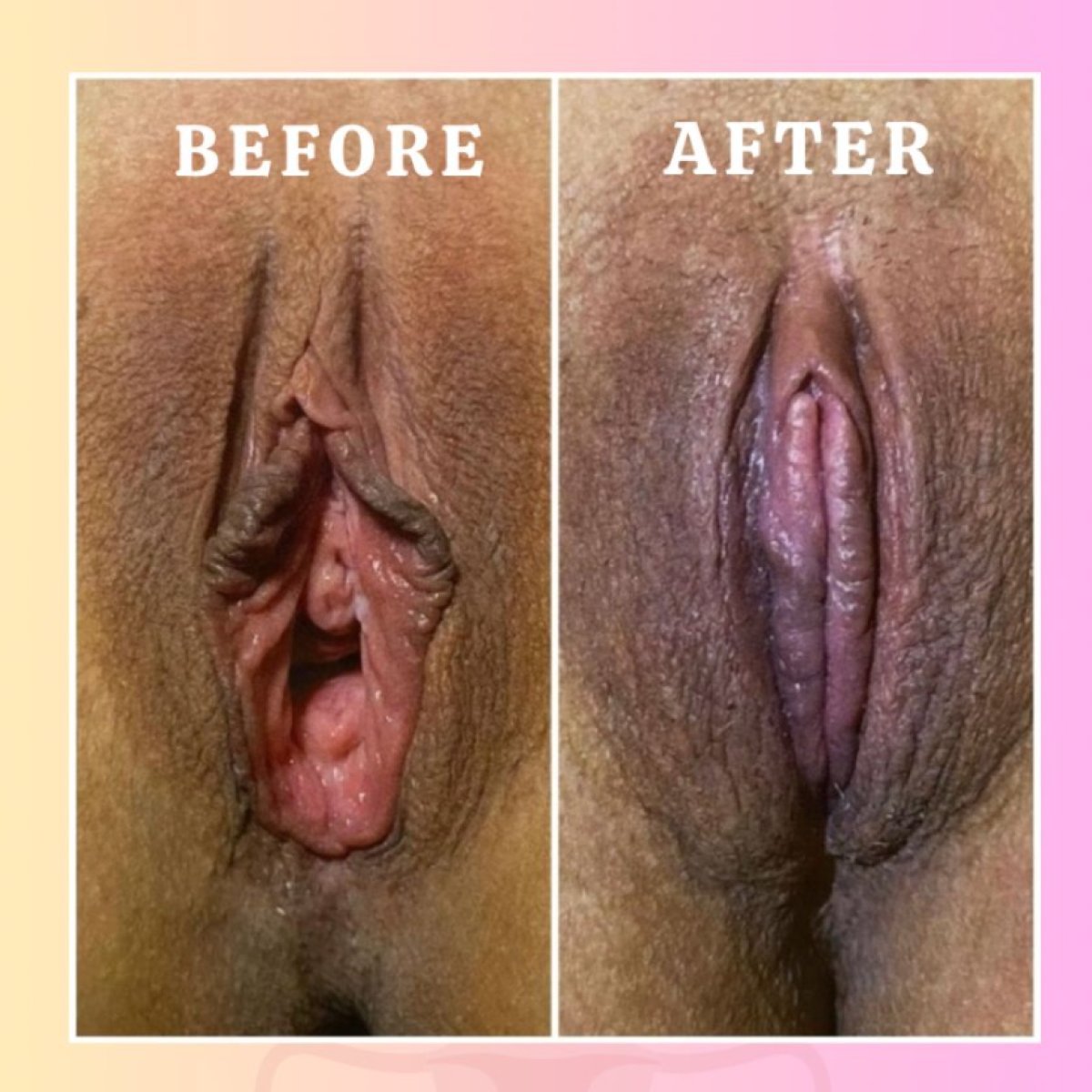 photo #1