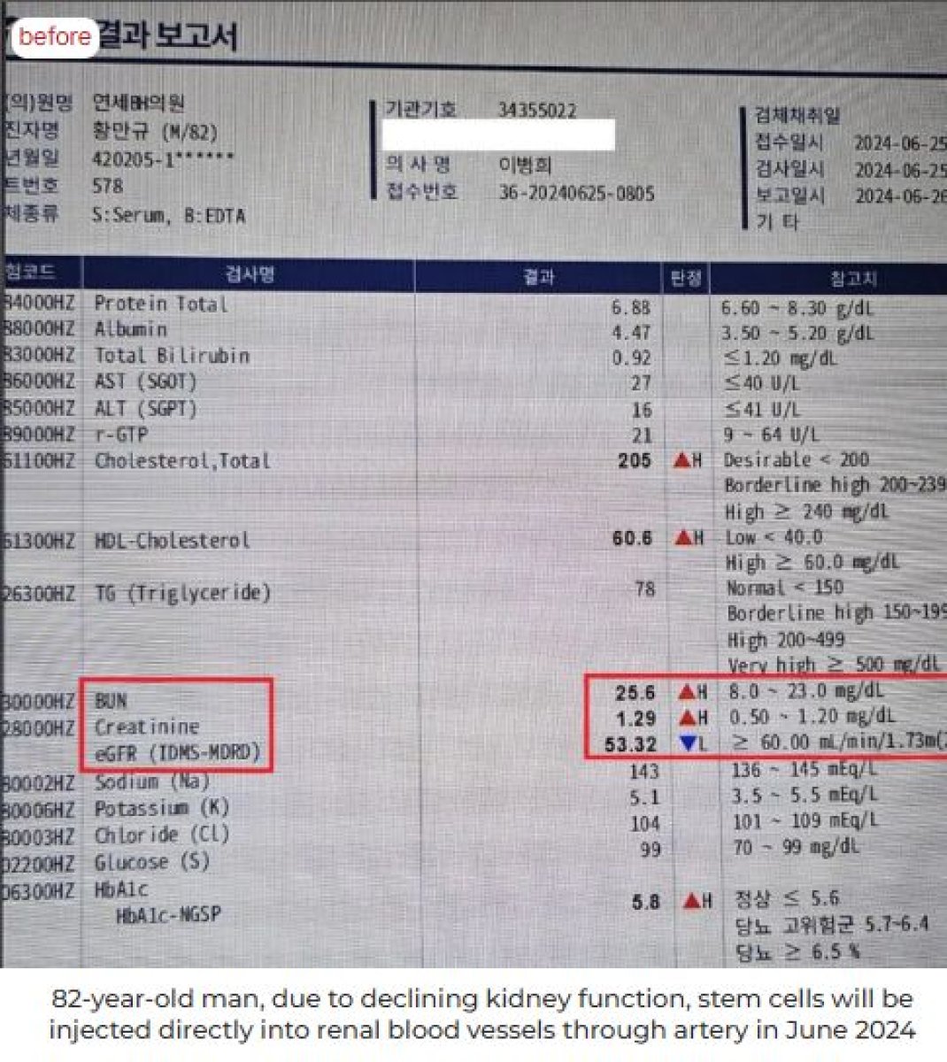 نتائج اختبار وظائف الكلى قبل تجديد الخلايا الجذعية في RE:YOUTH (YONSEI BH Arterial Stemcell Clinic)