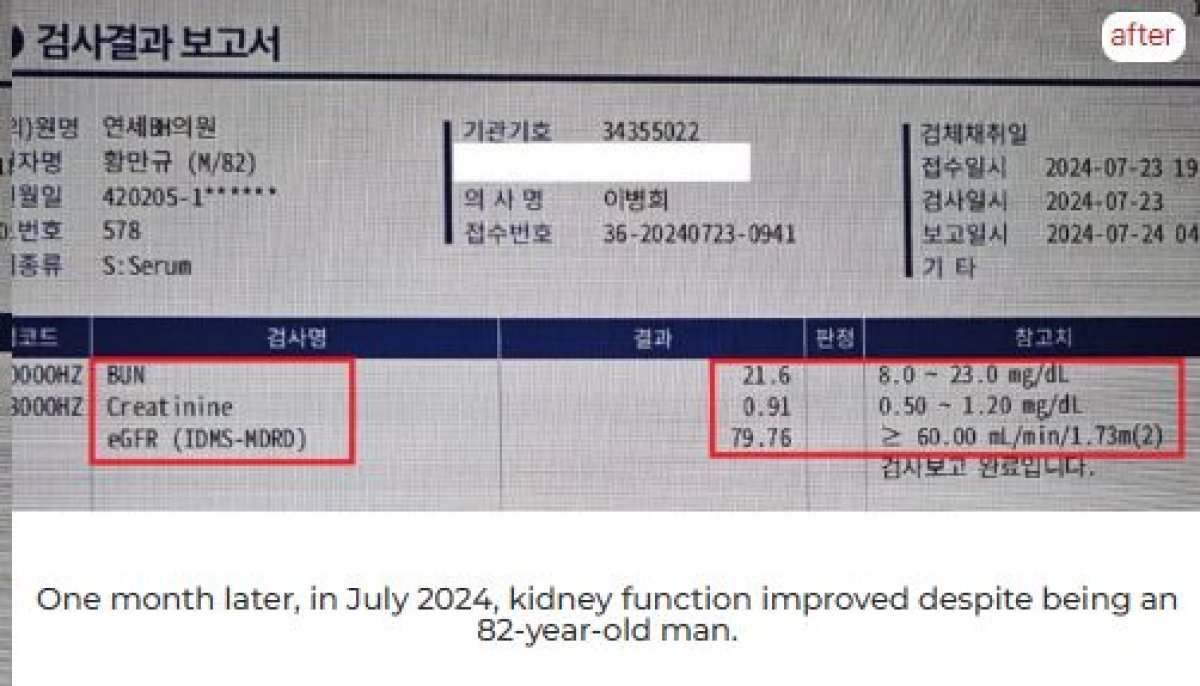 تحسن وظائف الكلى بعد علاج الخلايا الجذعية في RE:YOUTH (YONSEI BH Arterial Stemcell Clinic) النتيجة