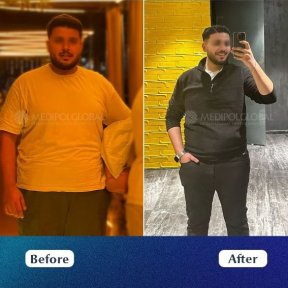 VIP Endoscopic Gastric Sleeve (ESG) – Scarless, Safe & Exclusive Weight Loss with Free FibroScan - photo 6