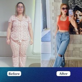 VIP Endoscopic Gastric Sleeve (ESG) – Scarless, Safe & Exclusive Weight Loss with Free FibroScan - photo 5