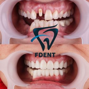 Best Smiles with the highest quality of materials and services/Your Smile is your first signature - photo 2