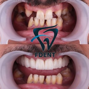 Best Smiles with the highest quality of materials and services/Your Smile is your first signature - photo 5