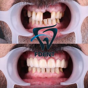 Best Smiles with the highest quality of materials and services/Your Smile is your first signature - photo 4