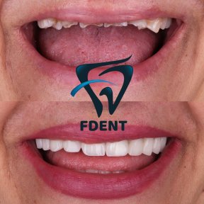 Best Smiles with the highest quality of materials and services/Your Smile is your first signature - photo 6