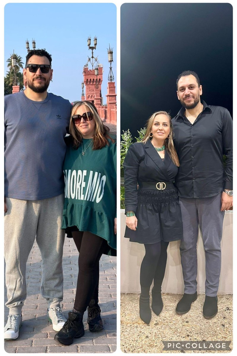 Before and after gastric sleeve surgery results at Dr. Islam Abdelkhalek's Clinic, weight loss