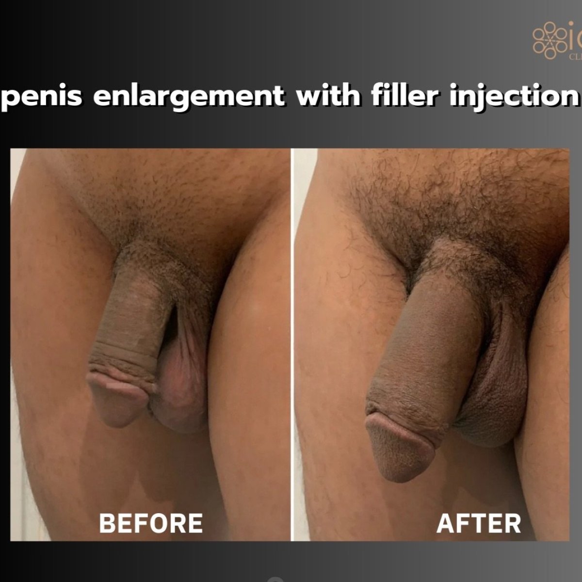 Әйелдердің виртуалды секс форумы