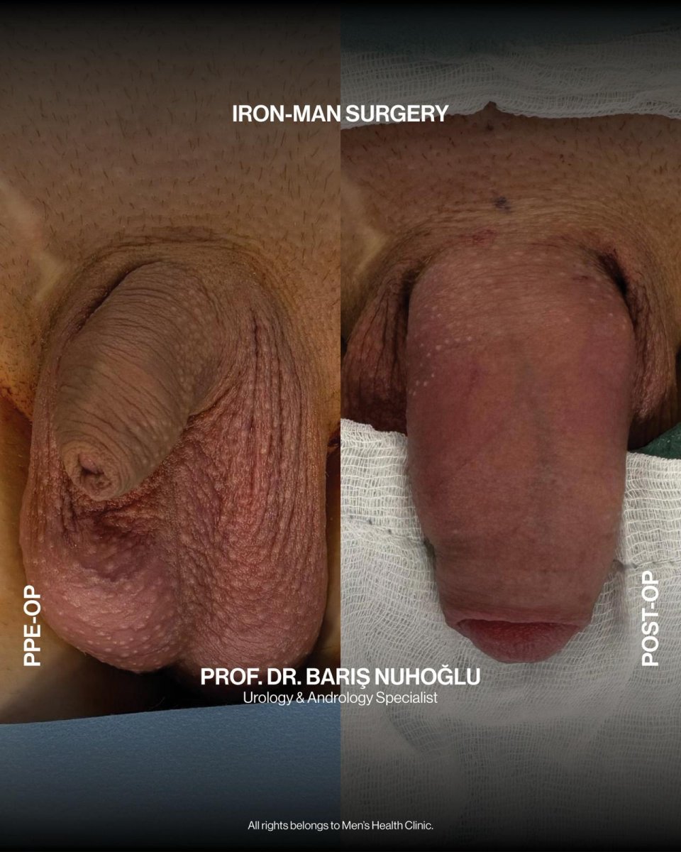 Қыздардың ең жақсы жеке порно фотосуреттері