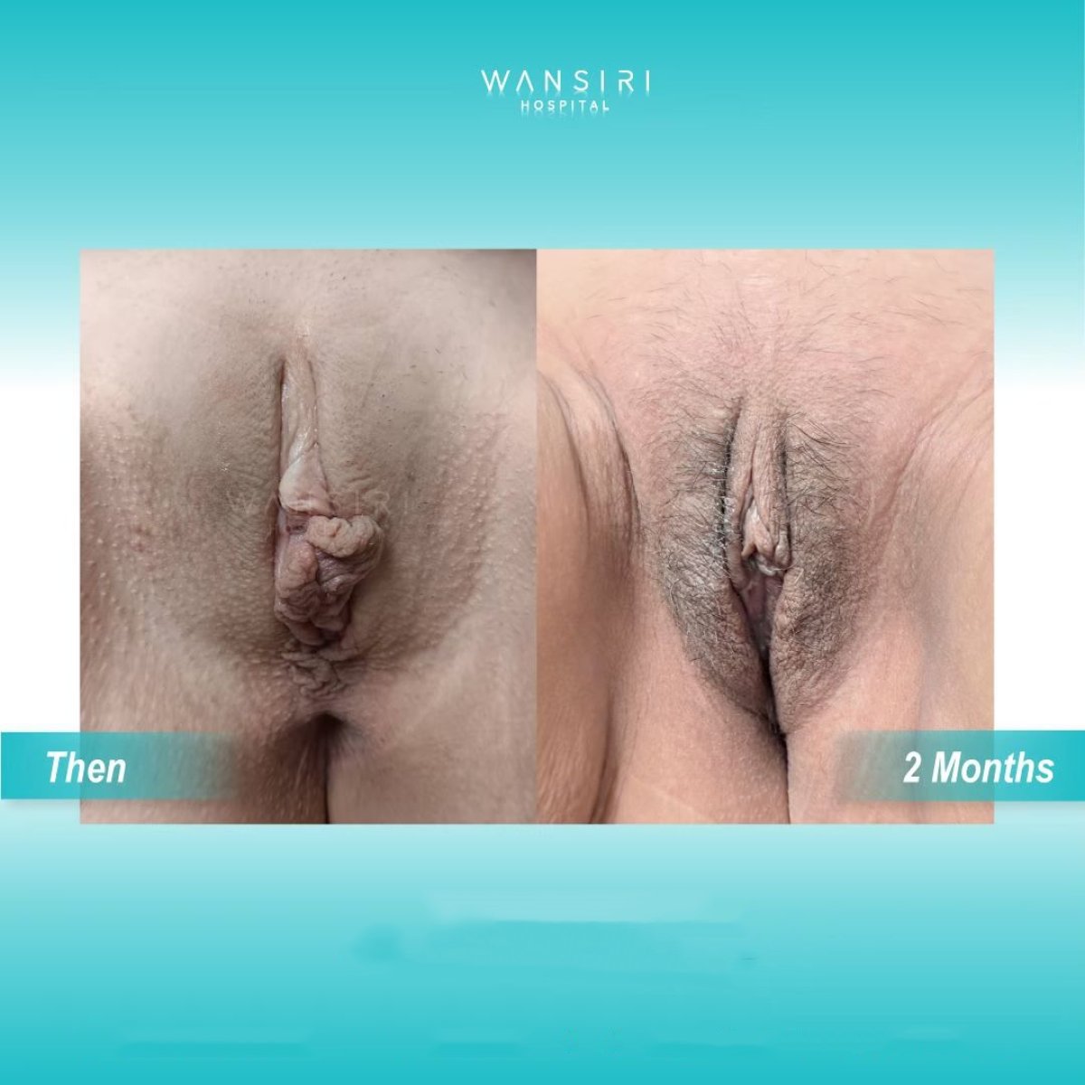 Тантрикалық клиторлық массаж Юбка киген бойжеткен жасырын камераға зейін қойып отыр.