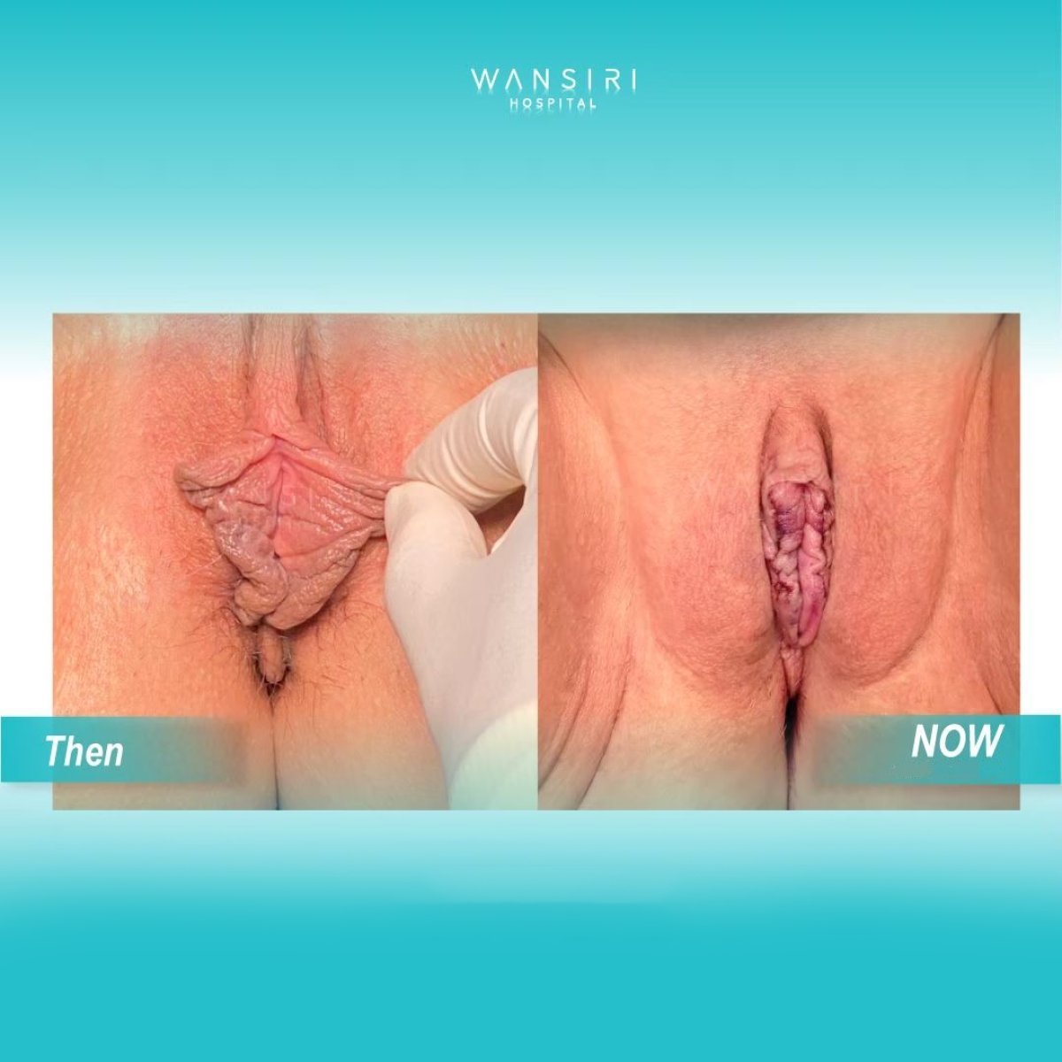 Анальды секс туралы ерлер форумы