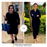 Before and after Желудочное шунтирование photos by Dr. Каплан Баха Темизгонул
