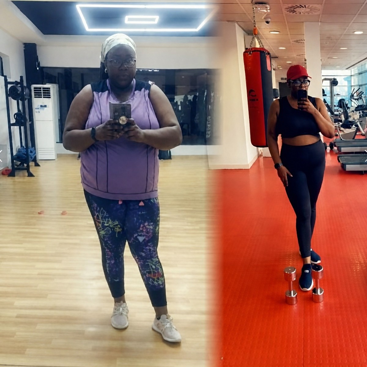 Before and after Roux-en-Y gastric bypass results at Dr. Islam Abdelkhalek's Clinic, weight loss