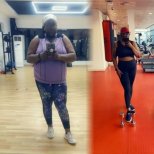 Before and after Roux-en-Y Gastric Bypass photos by Dr. Abdelkhalek