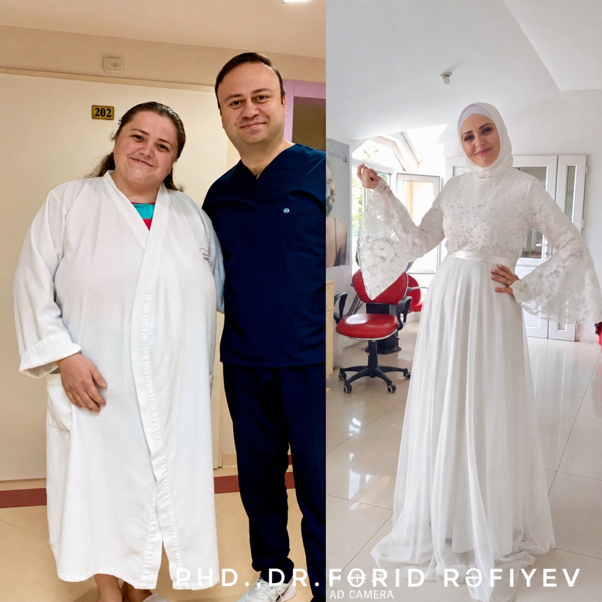 Before and after gastric sleeve surgery results at Liv Bona Dea Hospital Baku, visible weight loss