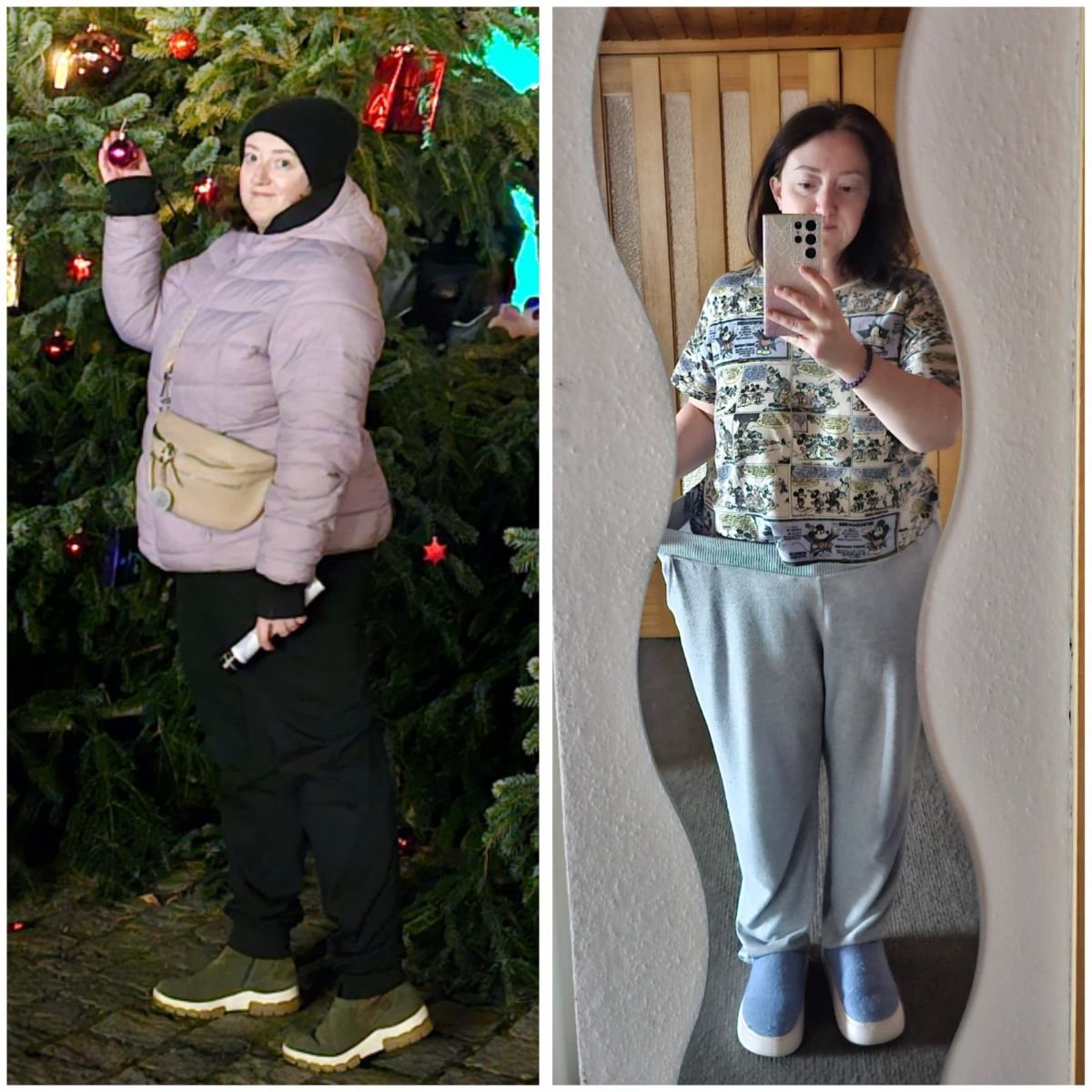 Before and after endoscopic sleeve gastroplasty at Lokman Hekim Istanbul Hospital, weight loss result