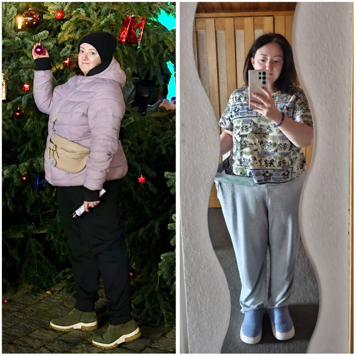 Avant et après sleeve gastrectomie à Lokman Hekim Istanbul Hospital, résultat perte de poids