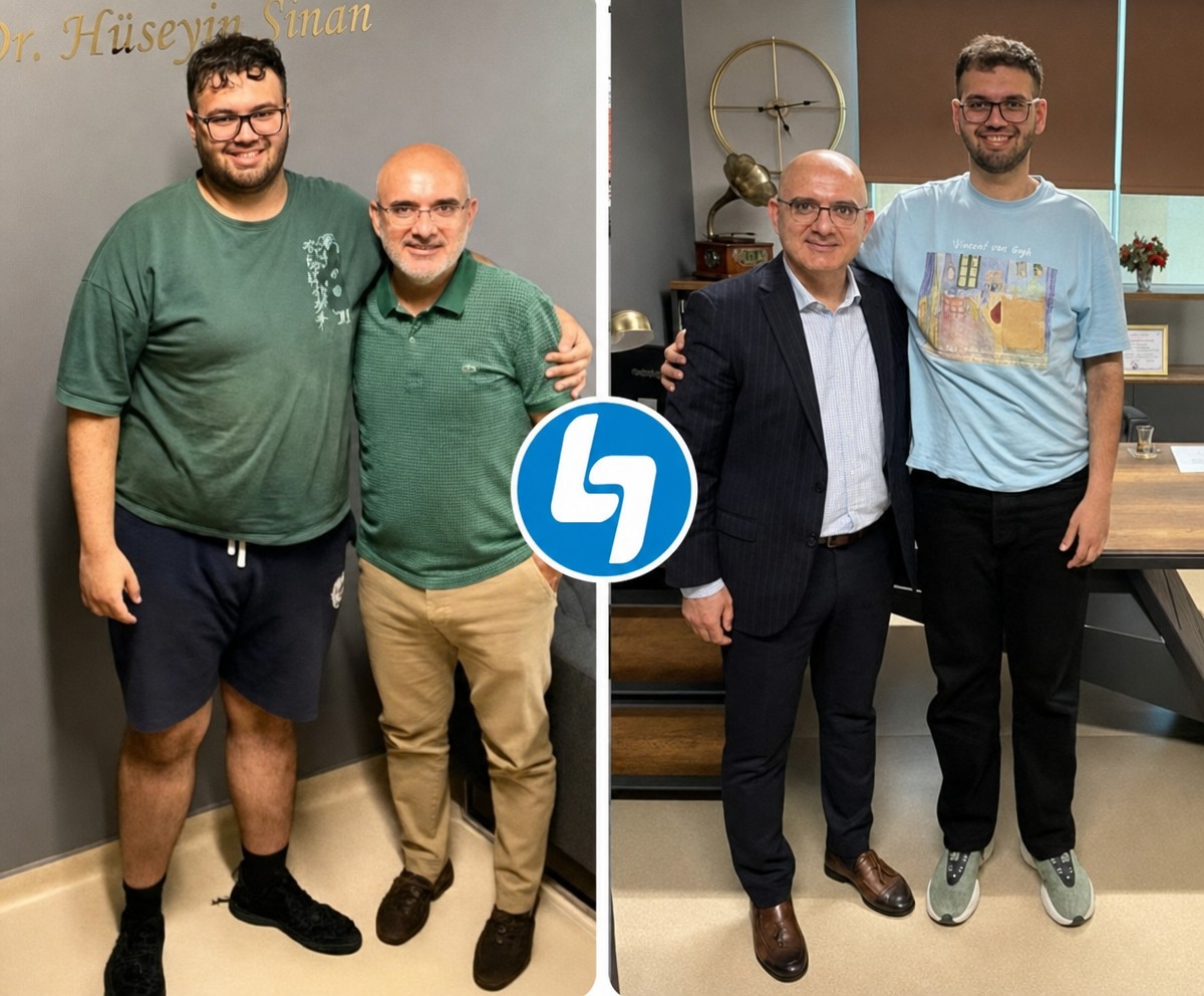 Avant et après sleeve gastrectomie à Lokman Hekim Istanbul Hospital, résultat perte de poids