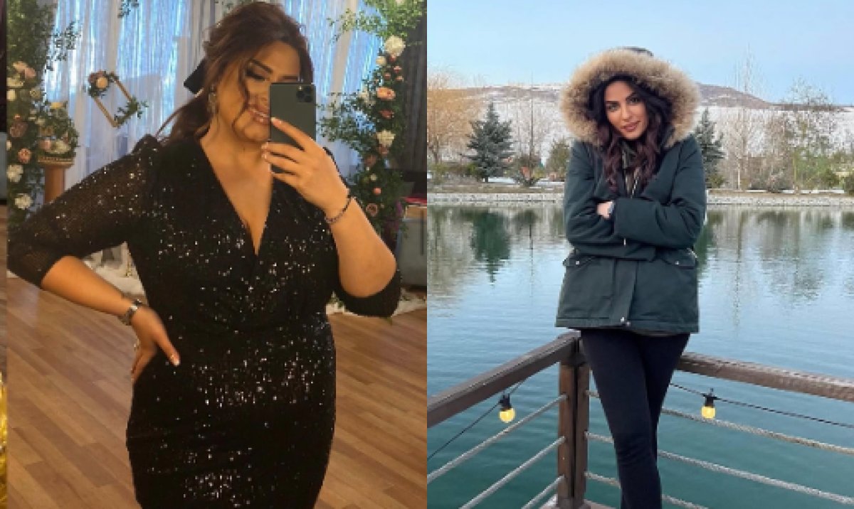 Antes y después de manga gástrica en ÜMRAN TIP MERKEZİ – resultados visibles de pérdida de peso