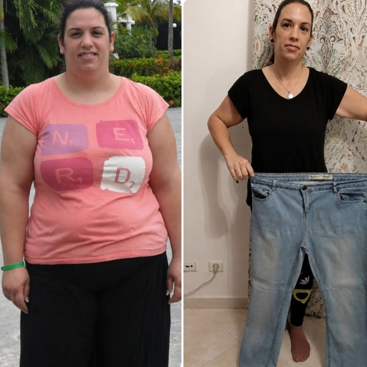 Before and after gastric sleeve surgery at Liv Hospital Vadistanbul, significant weight loss result