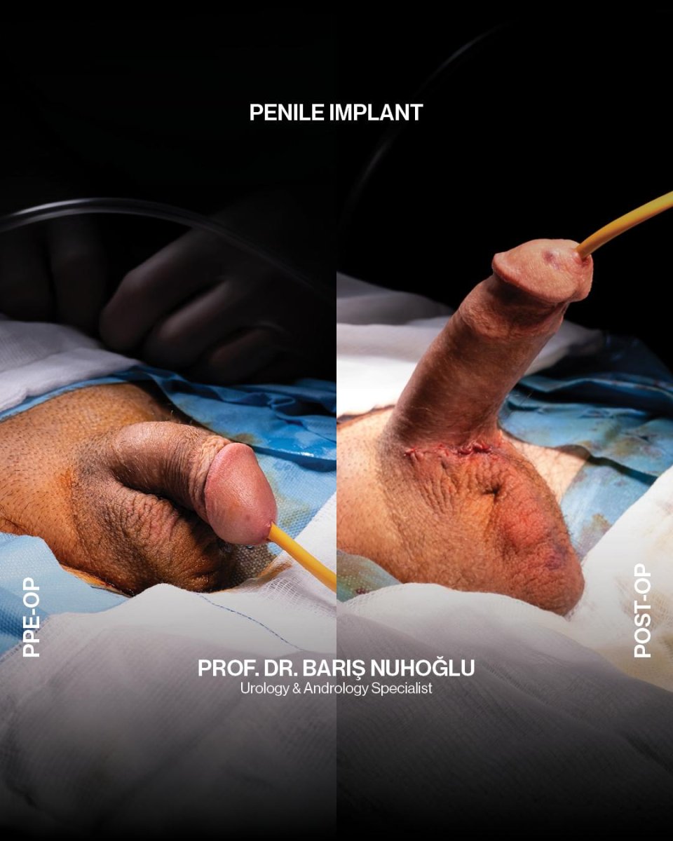 Дөрекі жыныстық қатынас кезінде ыңылдаған дыбыстар