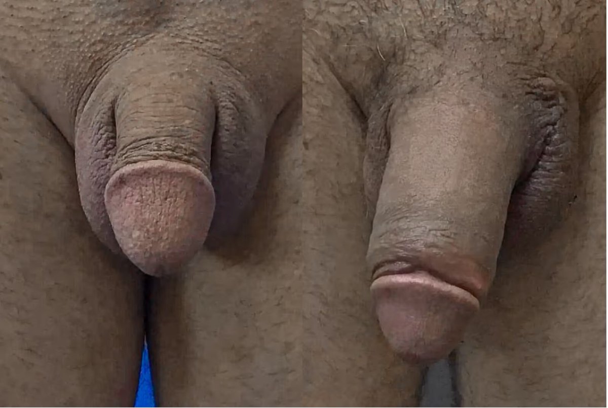 Porno video Olmaota yotoqxonasi