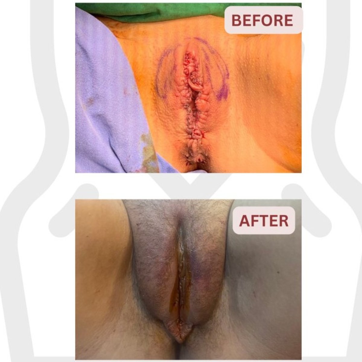 Семіз семіз жопа порно