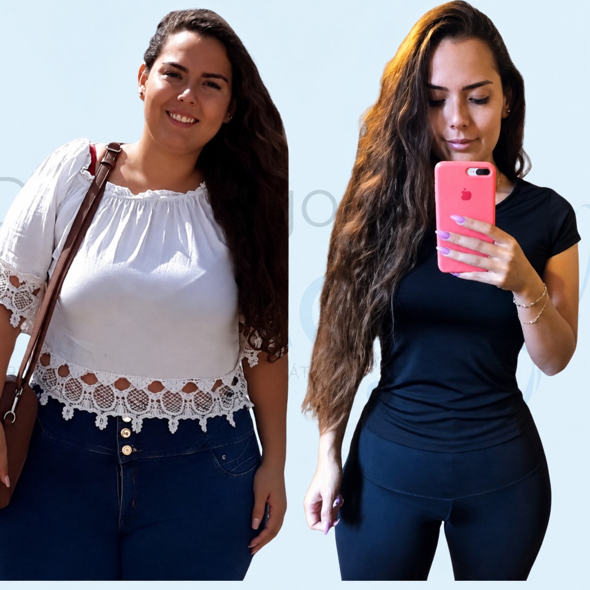 Résultats avant et après sleeve gastrique au Dr. Rodrigo Prieto Bariatric Center Mexique