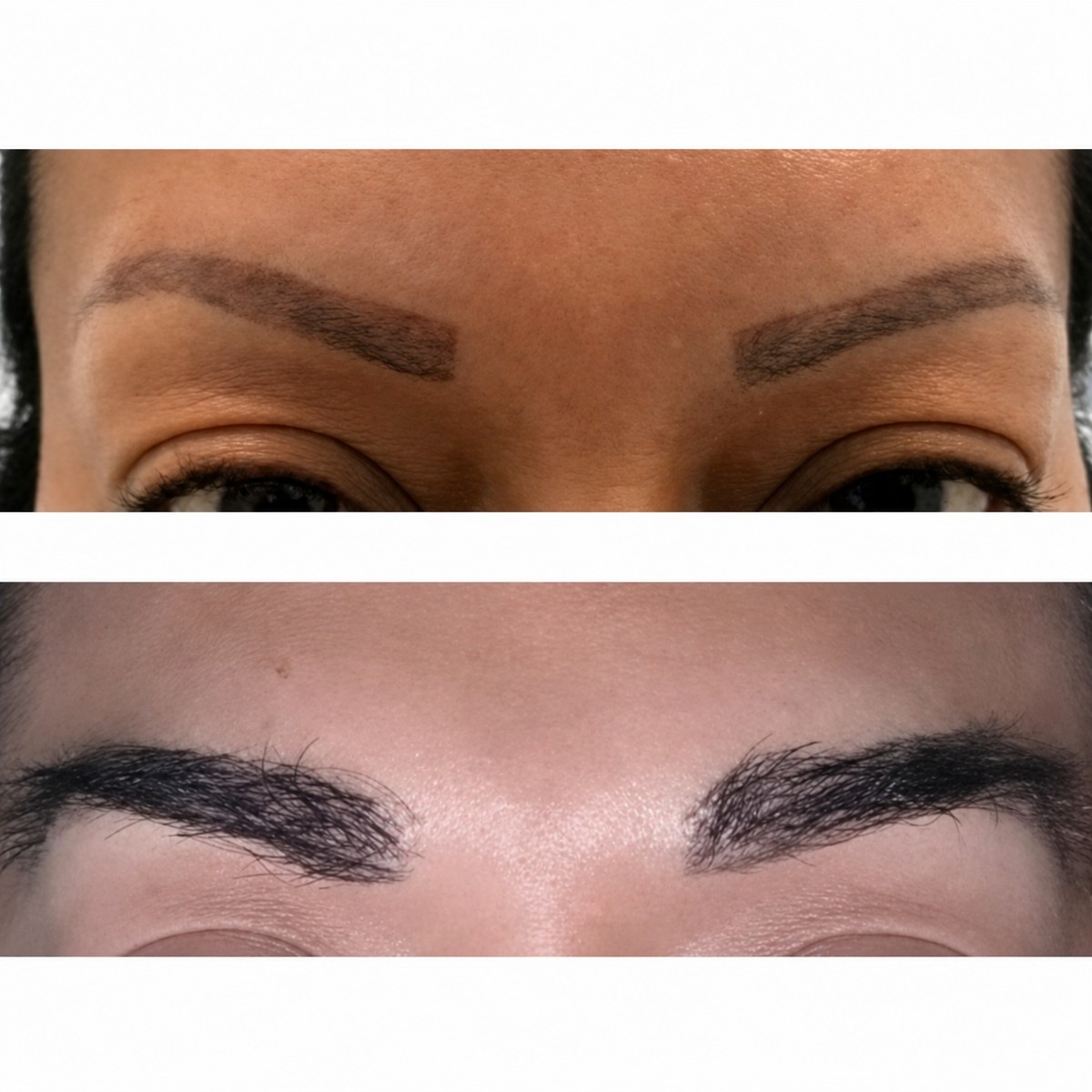 Resultados de trasplante de cejas antes y después en Hair In 1 Day Monterrey, cejas más densas