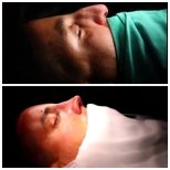 Фото до и после ринопластики кончика носа, доктор Хасан Шахин