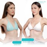 Before and after Breast augmentation photos by Dr. Saran Wannachamras