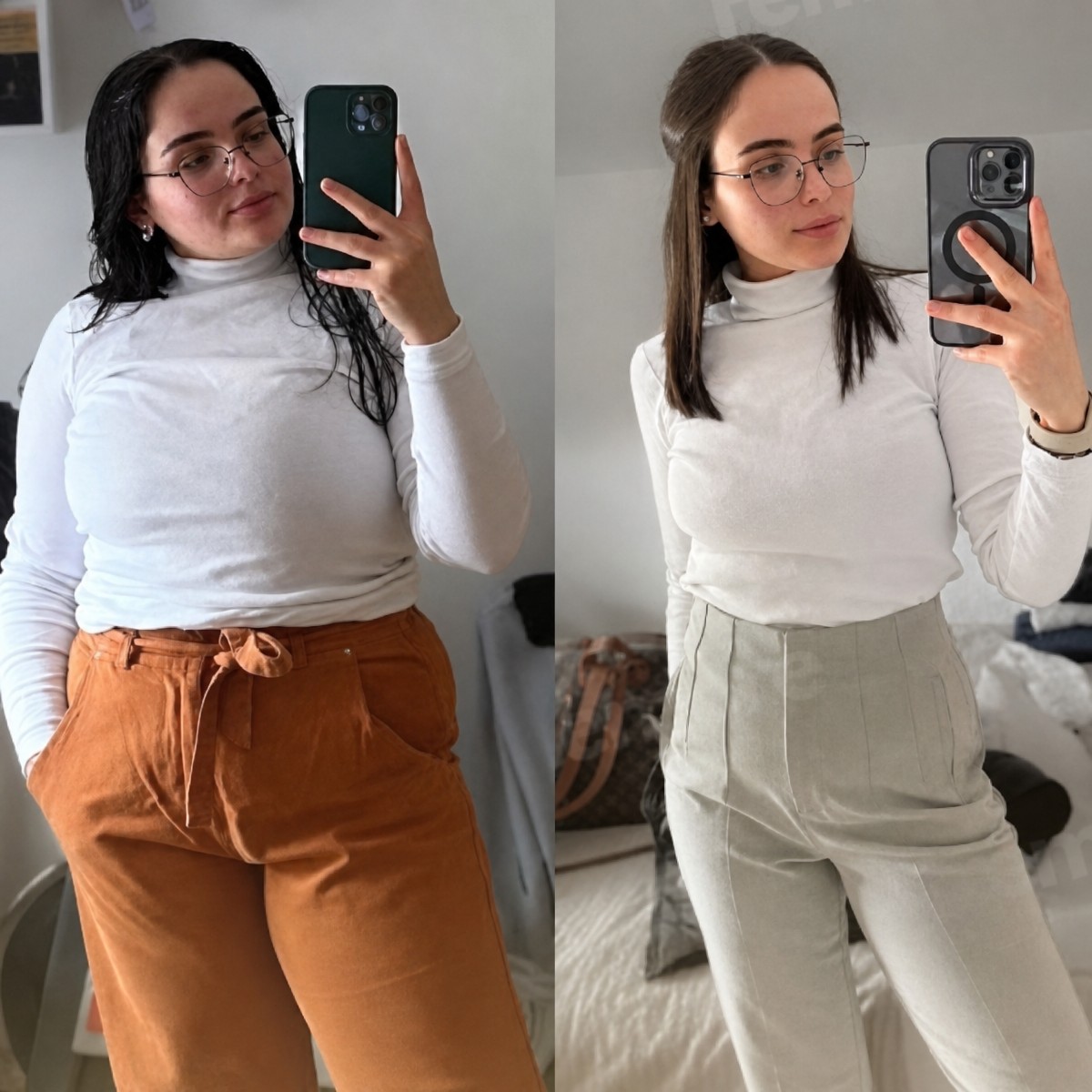 Before and after gastric balloon results at Memorial Göztepe Hospital, visible weight loss