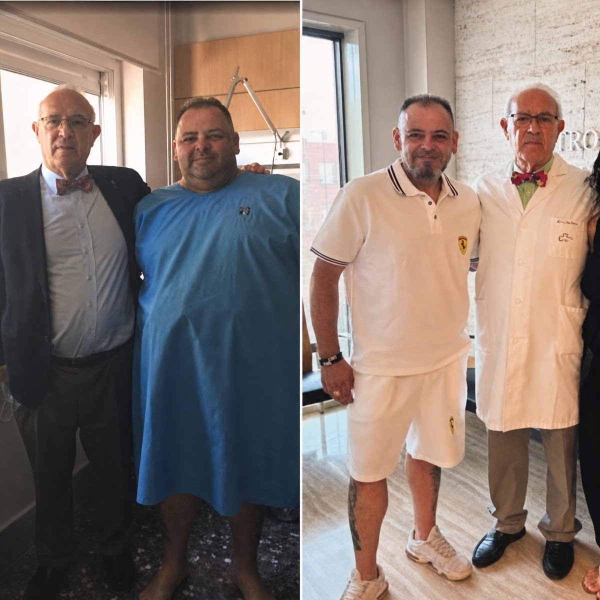 Before and after gastric band results at Centro Médico Teknon, significant weight loss visible