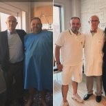 Before and after Gastric sleeve surgery (Sleeve gastrectomy) photos by Dr. Carlos Ballesta Lopez