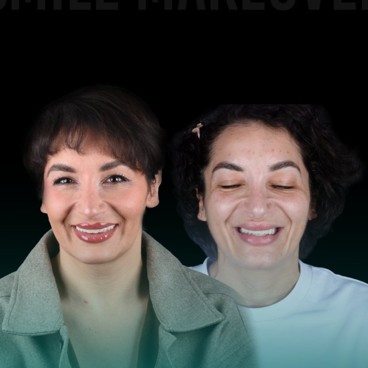 نتيجة قبل وبعد زراعة أسنان زركونيا All-on-4 في Soraca Med، تحول الابتسامة